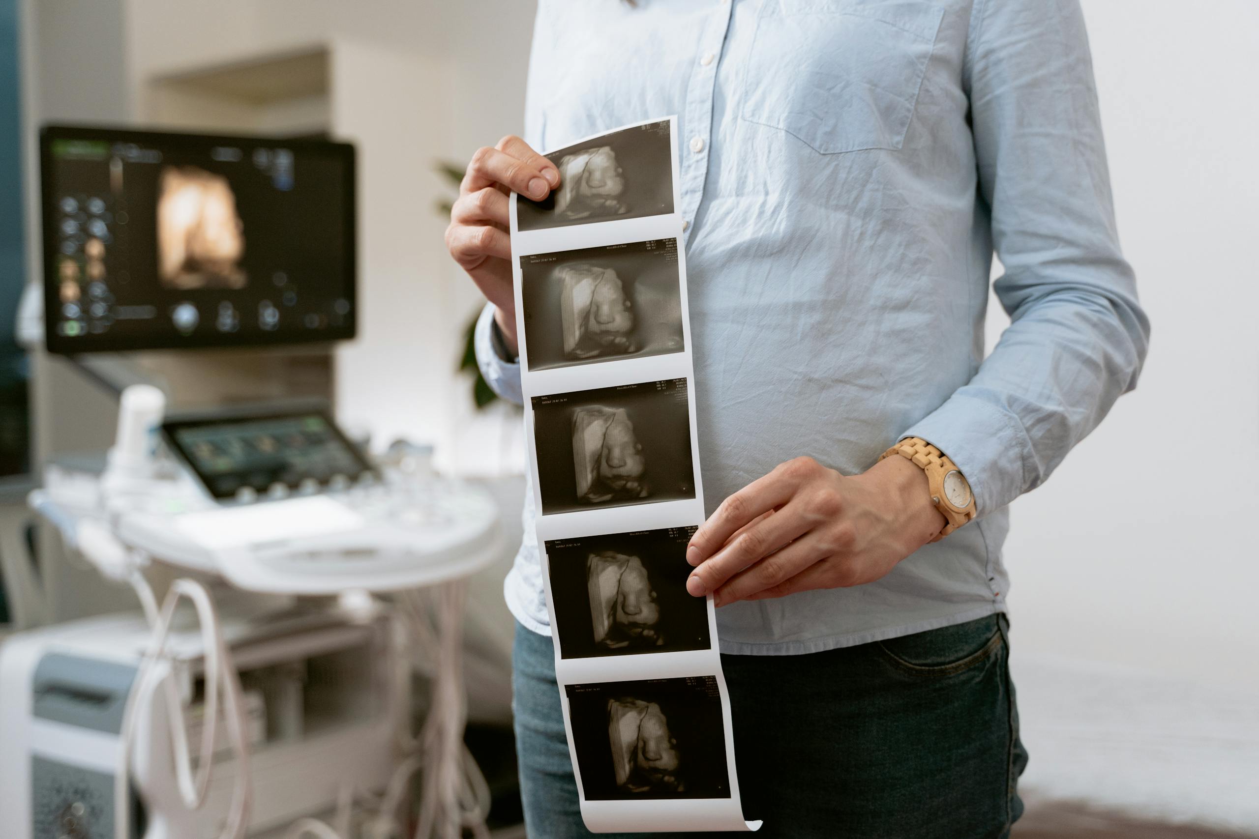 A person holding ultrasound images in a medical clinic, showcasing pregnancy monitoring.